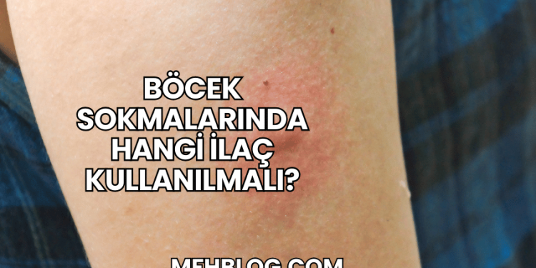Böcek Sokmalarında Hangi İlaç Kullanılmalı?