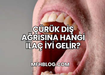 Çürük Diş Ağrısına Hangi İlaç İyi Gelir?