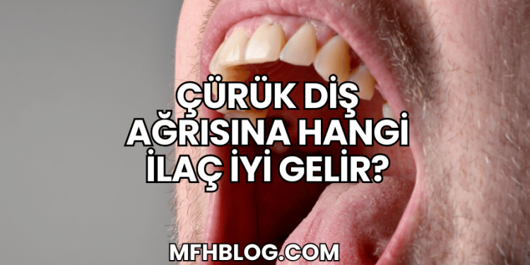 Çürük Diş Ağrısına Hangi İlaç İyi Gelir?