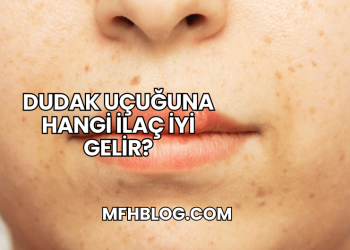 Dudak Uçuğuna Hangi İlaç İyi Gelir?