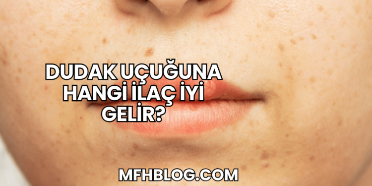 Dudak Uçuğuna Hangi İlaç İyi Gelir?