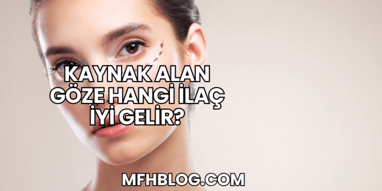Kaynak Alan Göze Hangi İlaç İyi Gelir?