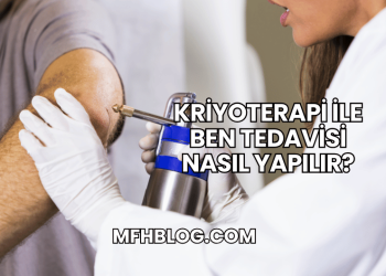 Kriyoterapi ile Ben Tedavisi Nasıl Yapılır?