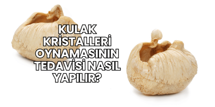 Kulak Kristalleri Oynamasının Tedavisi Nasıl Yapılır?
