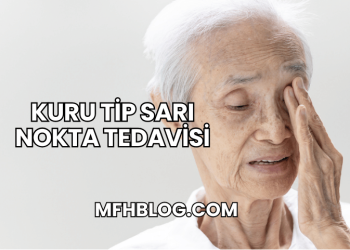 Kuru Tip Sarı Nokta Tedavisi