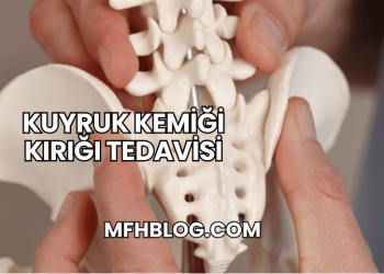 Kuyruk Kemiği Kırığı Tedavisi
