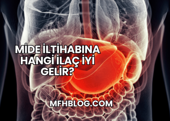 Mide İltihabına Hangi İlaç İyi Gelir?