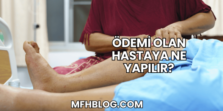 Ödemi Olan Hastaya Ne Yapılır?