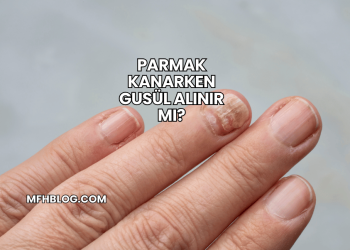 Parmak Kanarken Gusül Alınır mı?