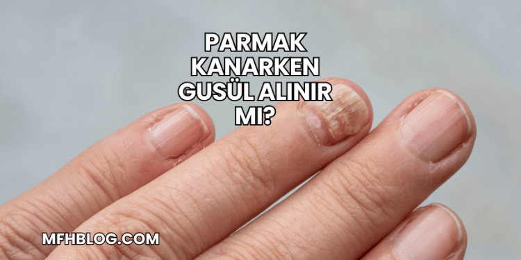 Parmak Kanarken Gusül Alınır mı?