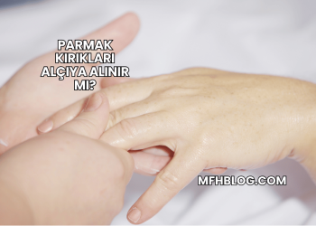 Parmak Kırıkları Alçıya Alınır mı?