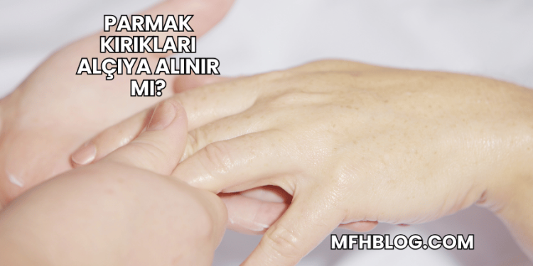 Parmak Kırıkları Alçıya Alınır mı?