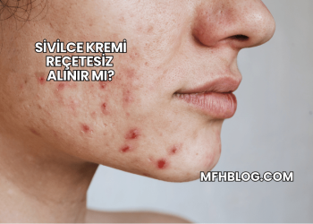 Sivilce Kremi Reçetesiz Alınır mı?