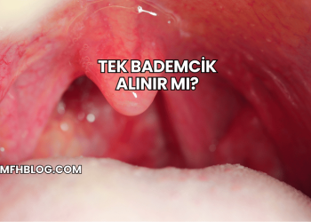 Tek Bademcik Alınır mı?