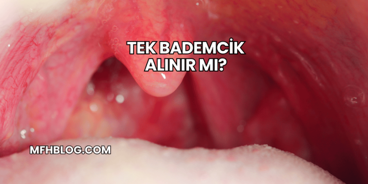 Tek Bademcik Alınır mı?