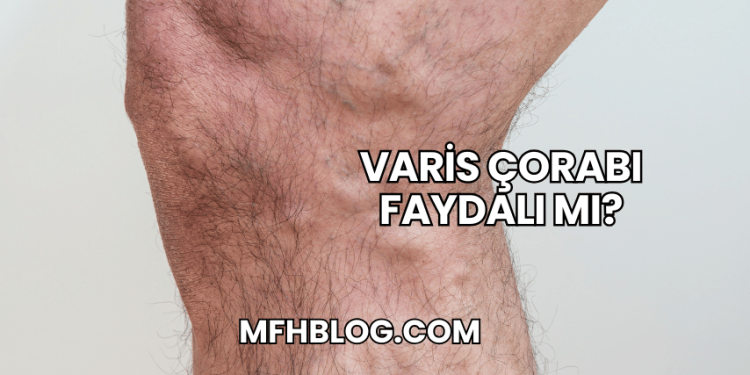 Varis Çorabı Faydalı mı?