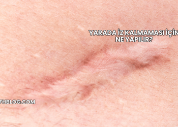 Yarada İz Kalmaması İçin Ne Yapılır?