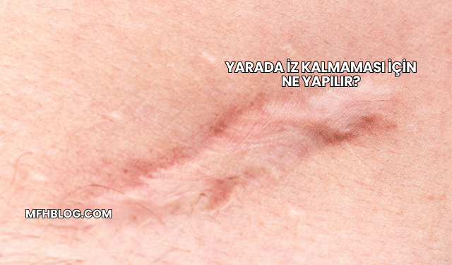 Yarada İz Kalmaması İçin Ne Yapılır?