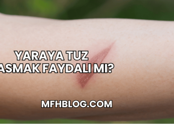 Yaraya Tuz Basmak Faydalı mı?