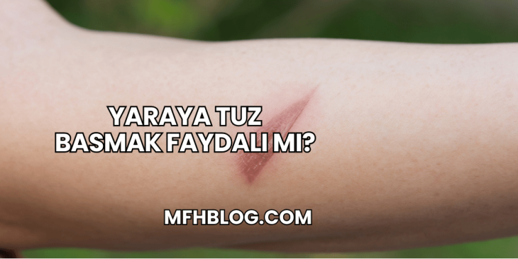 Yaraya Tuz Basmak Faydalı mı?