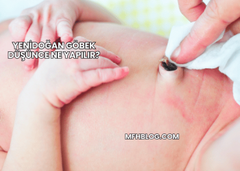 Yenidoğan Göbek Düşünce Ne Yapılır?