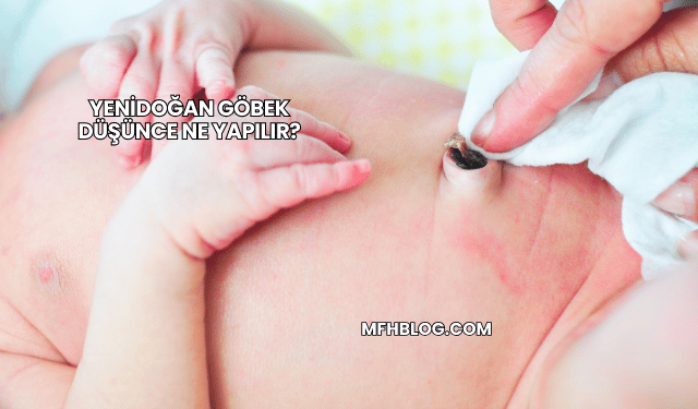Yenidoğan Göbek Düşünce Ne Yapılır?