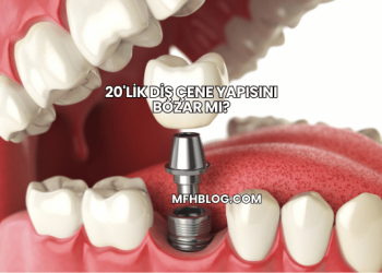 20'lik Diş Çene Yapısını Bozar mı?