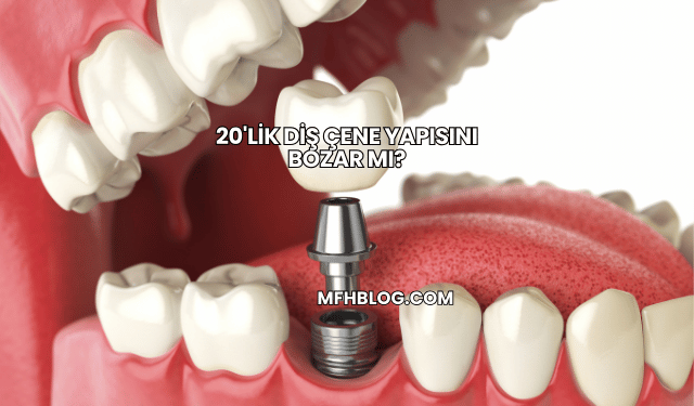 20'lik Diş Çene Yapısını Bozar mı?