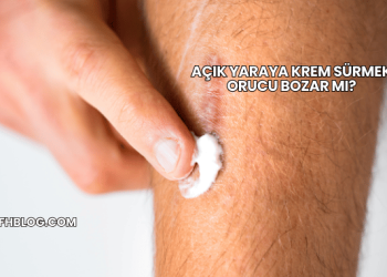 Açık Yaraya Krem Sürmek Orucu Bozar mı?