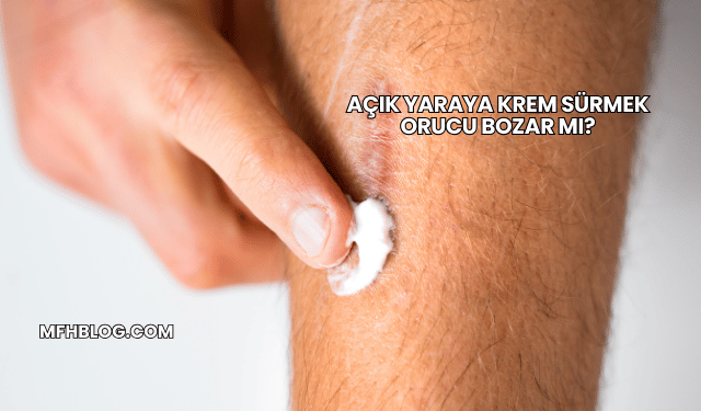 Açık Yaraya Krem Sürmek Orucu Bozar mı?