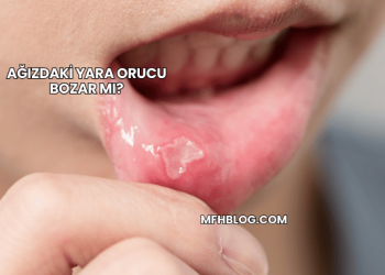 Ağızdaki Yara Orucu Bozar mı?