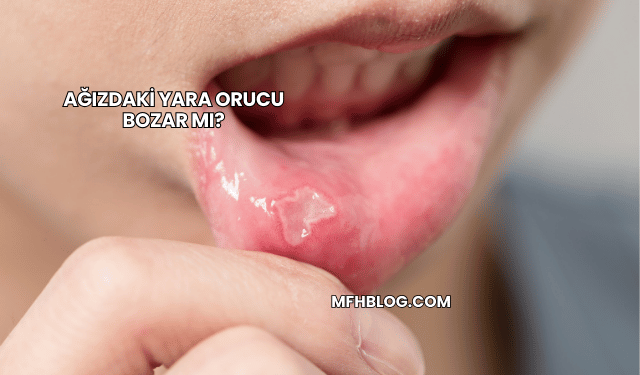 Ağızdaki Yara Orucu Bozar mı?