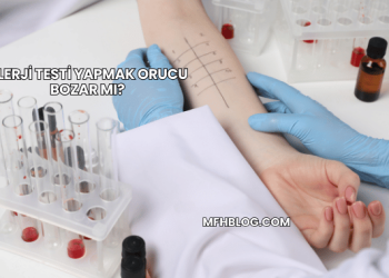 Alerji Testi Yapmak Orucu Bozar mı?