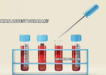 Az Kan Abdest Bozar mı?