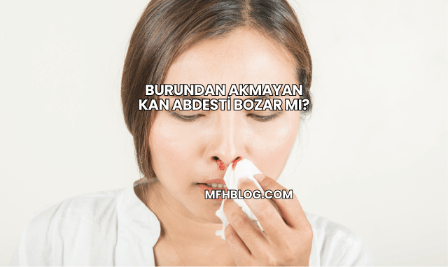 Burundan Akmayan Kan Abdesti Bozar mı?