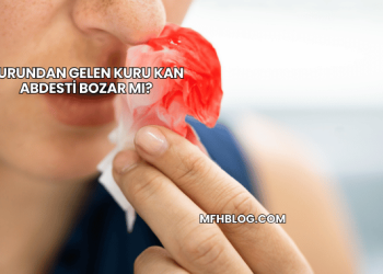 Burundan Gelen Kuru Kan Abdesti Bozar mı?