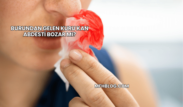 Burundan Gelen Kuru Kan Abdesti Bozar mı?