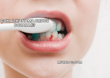 Çok Az Kanama Orucu Bozar mı?