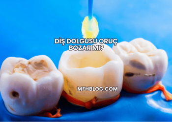 Diş Dolgusu Oruç Bozar mı?