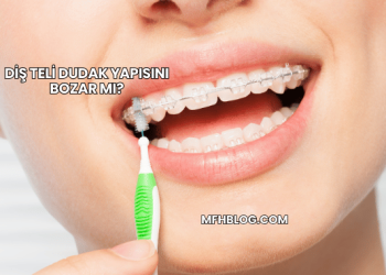 Diş Teli Dudak Yapısını Bozar mı?