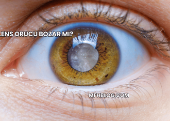 Lens Orucu Bozar mı?