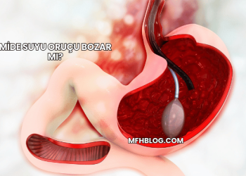 Mide Suyu Oruçu Bozar mı?