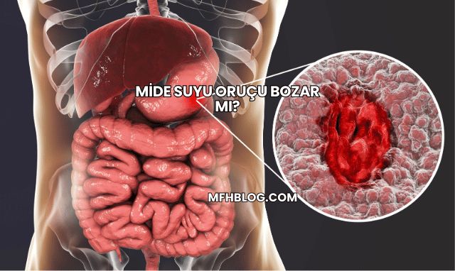 Mide Suyu Oruçu Bozar mı?
