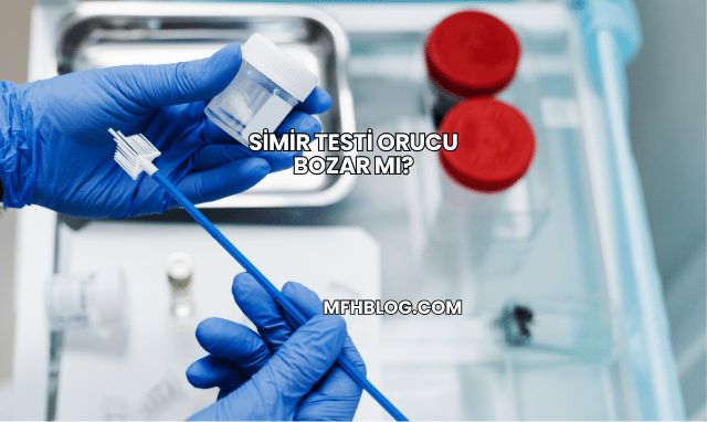 Simir Testi Orucu Bozar mı?
