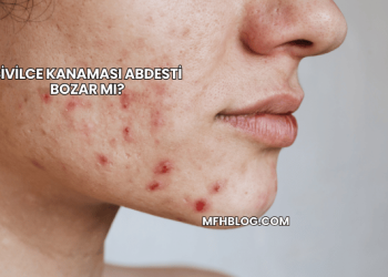 Sivilce Kanaması Abdesti Bozar mı?