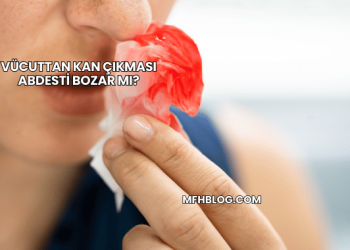 Vücuttan Kan Çıkması Abdesti Bozar mı?
