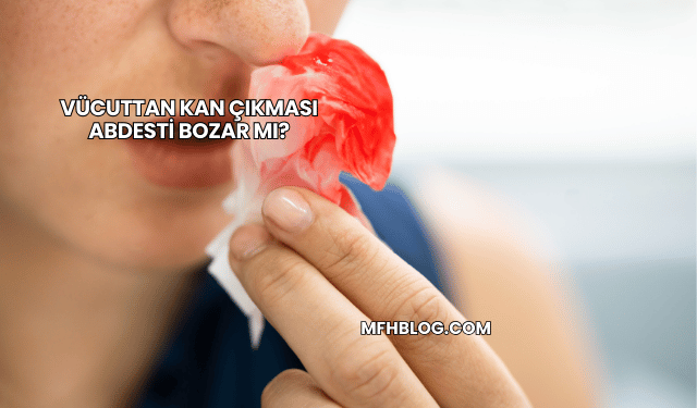 Vücuttan Kan Çıkması Abdesti Bozar mı?