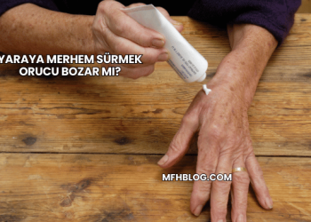 Yaraya Merhem Sürmek Orucu Bozar mı?
