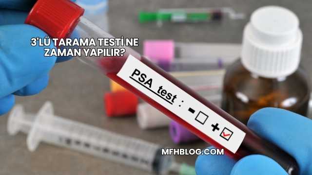 3'lü Tarama Testi Ne Zaman Yapılır?