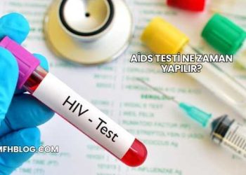 Aids Testi Ne Zaman Yapılır?